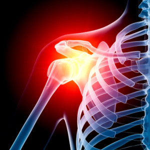ShoulderPain