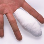 15 injuries in 5 years, including 3 amputations: $503K OSHA fine