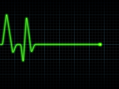 heart stop
